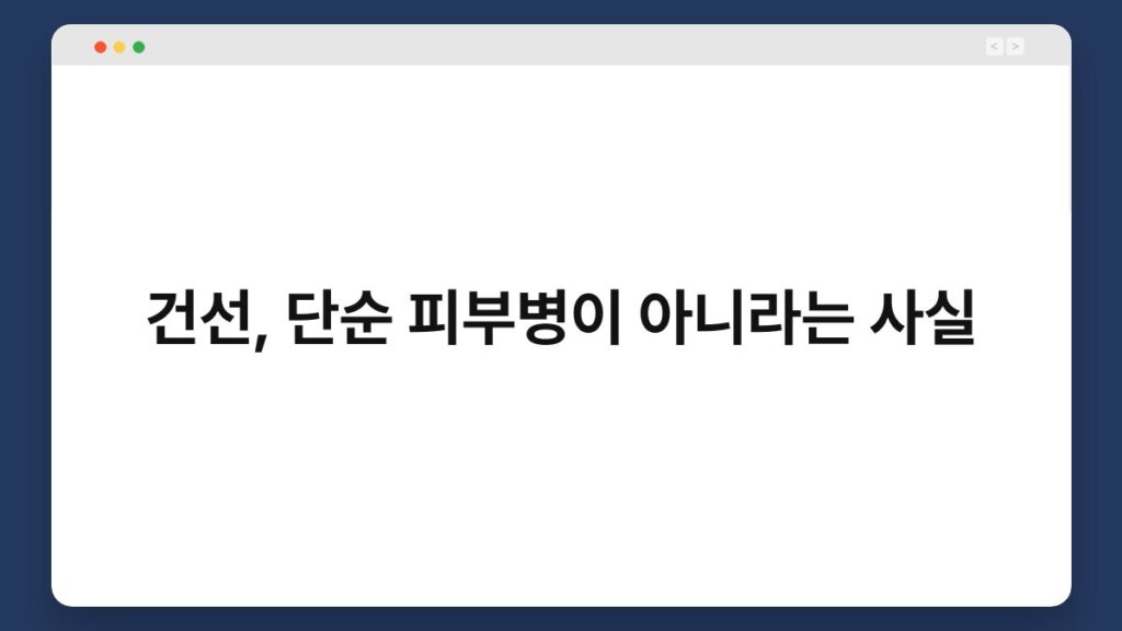 건선, 단순 피부병이 아니라는 사실 2