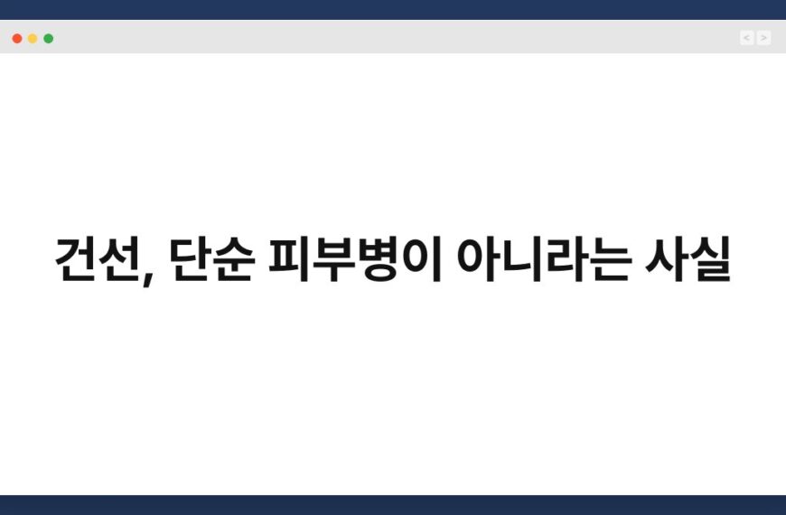 건선, 단순 피부병이 아니라는 사실 3