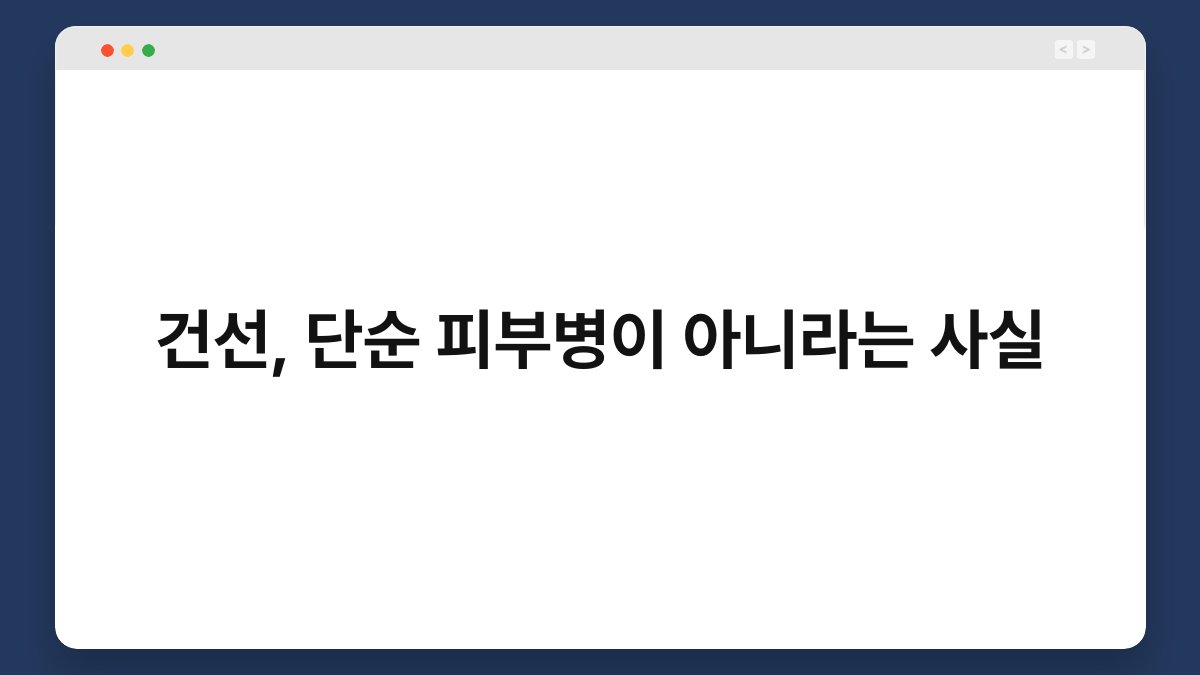 건선, 단순 피부병이 아니라는 사실 1